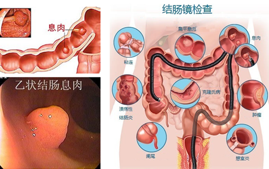 萎縮性胃炎真的“很嚇人”？看完這“七個(gè)事實(shí)”你就明白了