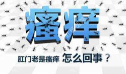 肛門瘙癢治不好嗎？先檢查病因就好辦！